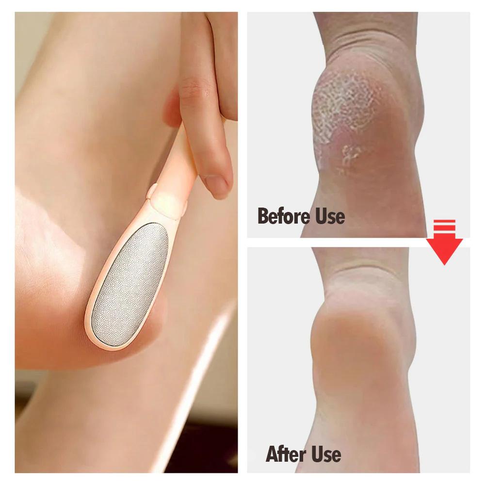 Stainless Steel Nail and Foot File 2 in 1 Tool LFT 01 07